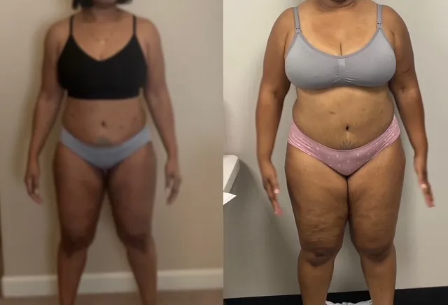 Client transformation — AfterBurns Fitness
